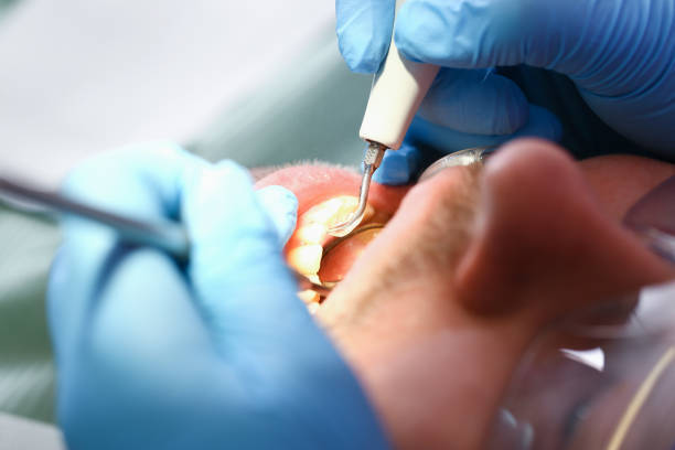 Best Emergency Gum Treatment in Mcgehee, AR